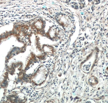 SPRY2 Antibody
