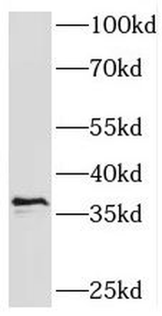 SPRY4 Antibody