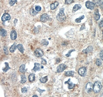 SPRY4 Antibody