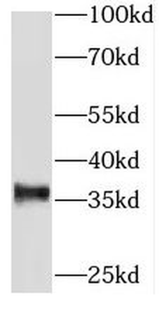 TRIM51 Antibody
