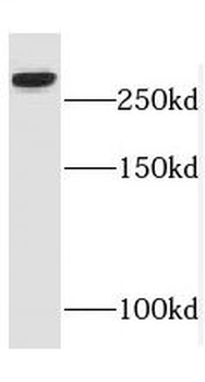 SPTBN1 Rabbit Polyclonal Antibody