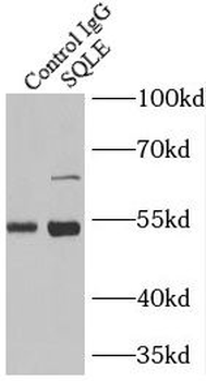 SQLE Antibody