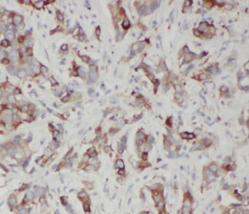 SQLE Antibody