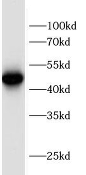 SQOR Rabbit Polyclonal Antibody