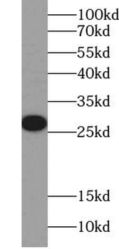 SRA1 Rabbit Polyclonal Antibody
