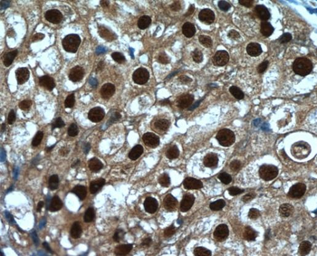 SRA1 Rabbit Polyclonal Antibody