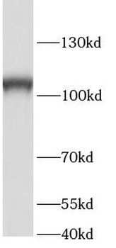 SRBD1 Rabbit Polyclonal Antibody