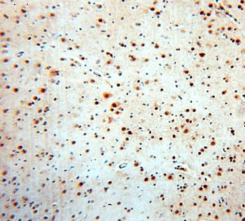 SRF Antibody