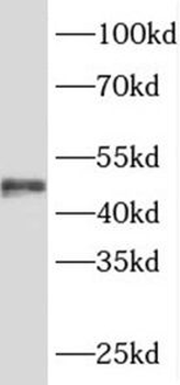 SRFBP1 Antibody