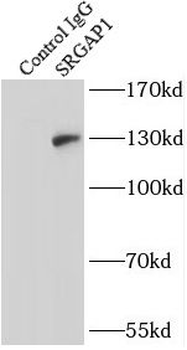 SRGAP1 Antibody