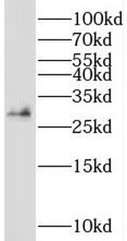 SRPRB Antibody