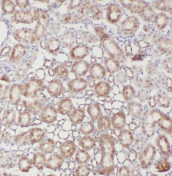SRR Antibody