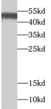 SSB Rabbit Polyclonal Antibody