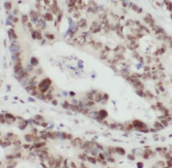 SSB Rabbit Polyclonal Antibody
