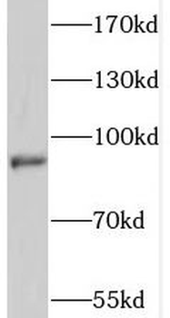 SSH3 Rabbit Polyclonal Antibody