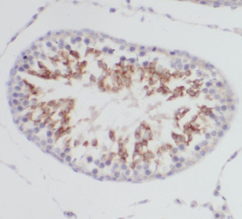 SSH3 Rabbit Polyclonal Antibody