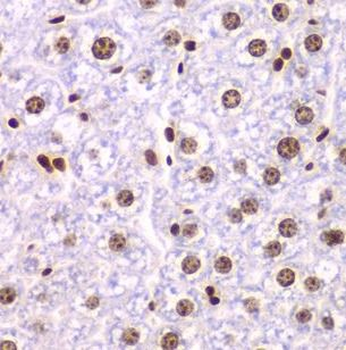 SSRP1 Antibody