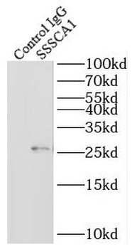ZNRD2 Antibody