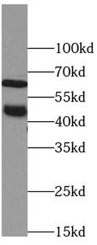 SSTR1 Antibody