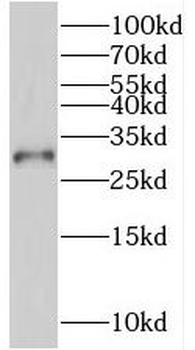 SSU72 Antibody