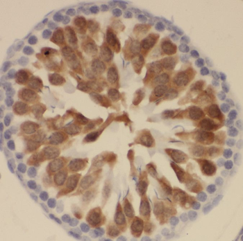 SSX4 Antibody