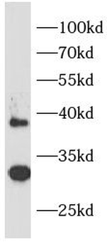 IL1RL1 Antibody