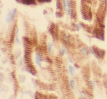 IL1RL1 Antibody