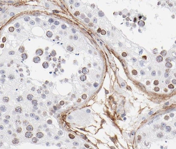 ST3GAL4 Antibody