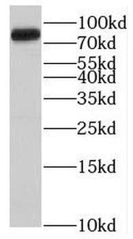 DENND2B Antibody