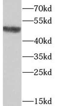 ST6GAL1 Antibody
