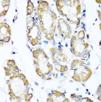 ST6GAL1 Antibody