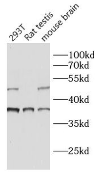 ST6GALNAC5 Antibody