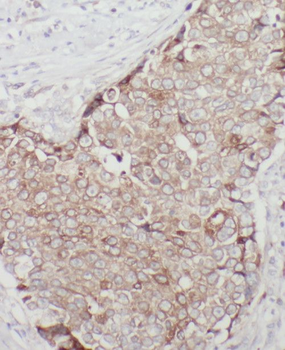 ST6GALNAC5 Antibody