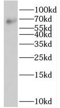 ST7 Antibody