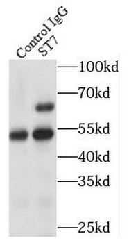 ST7 Antibody