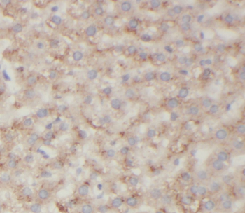 ST7 Antibody