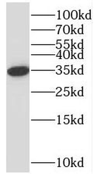 STARD10 Antibody