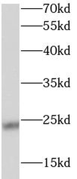 STARD5 Antibody