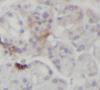 STARD5 Antibody