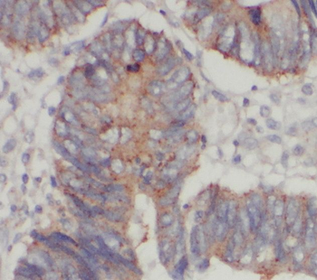 STARD7 Antibody