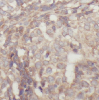 STAT1 Antibody