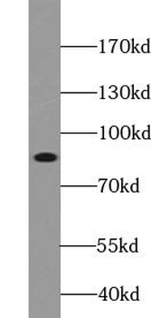STAT3 Rabbit Polyclonal Antibody