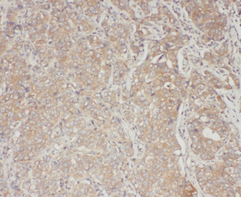 STAT3 Rabbit Polyclonal Antibody