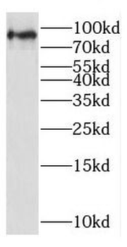 STAT3 Rabbit Polyclonal Antibody