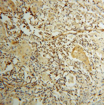 STAT3 Rabbit Polyclonal Antibody