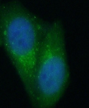 STAT3 Antibody