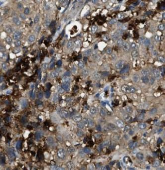 STAT3 Antibody