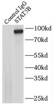 STAT5B Antibody