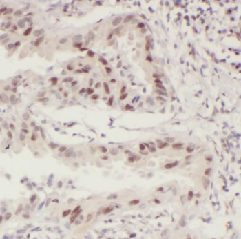 STAT5B Antibody