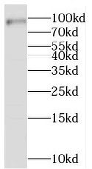 STAT5B Rabbit Polyclonal Antibody